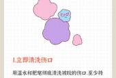 清创恐怖图片，清创比较不恐怖的图片