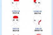 怎样判断自己的头痛类型，怎样判断自己的头痛类型和症状？