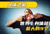 世界上睾丸最大的人，这个世界睾丸最大的人是谁
