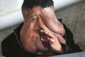 世界上最丑的人长什么样图片，世界上最丑的人是谁的图片