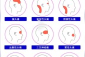 怎么区分偏头痛和神经性头痛，三叉神经疼的6个症状