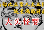 香港大头怪婴最后去哪了？香港大头怪婴最后去哪了儿子医院在医院香港医院？