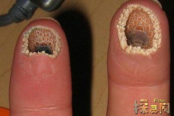 黑芝麻进入毛孔？黑芝麻堵住毛孔？  第5张