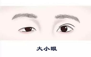怎样判断自己是阴阳眼，怎么判断自己是阴阳眼？  第6张
