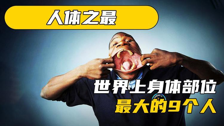 世界上睾丸最大的人，这个世界睾丸最大的人是谁  第1张