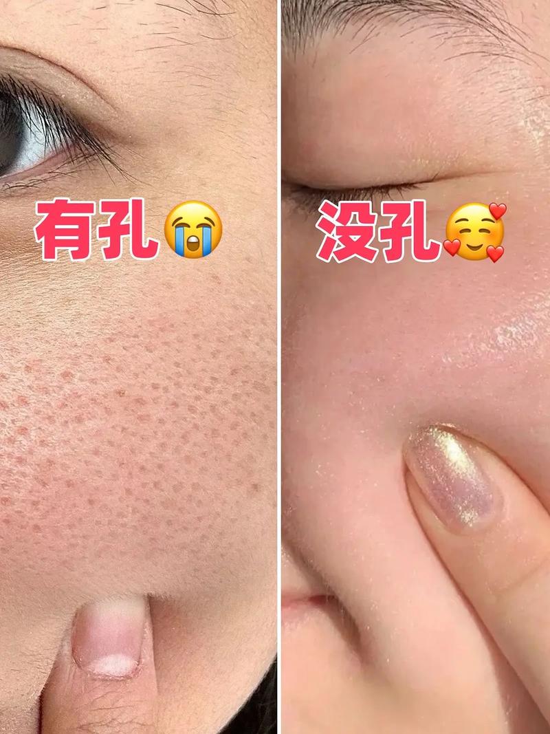 汗毛孔芝麻，汗毛孔芝麻图片？  第1张