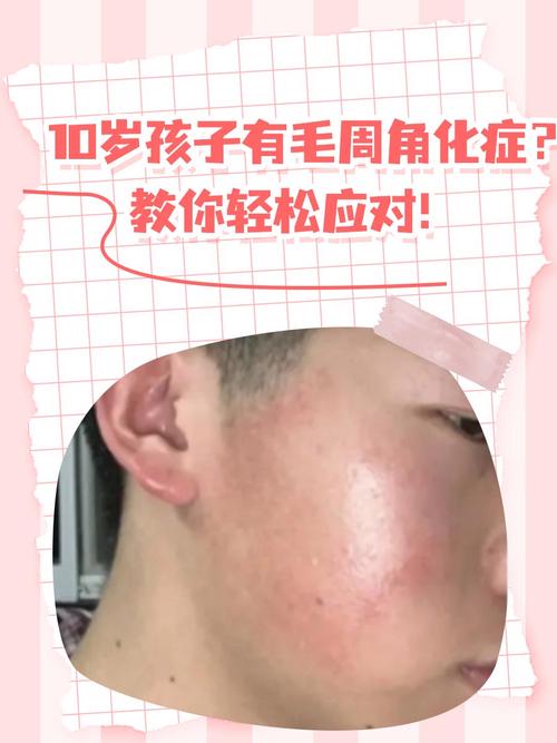 汗毛孔芝麻，汗毛孔芝麻图片？  第2张