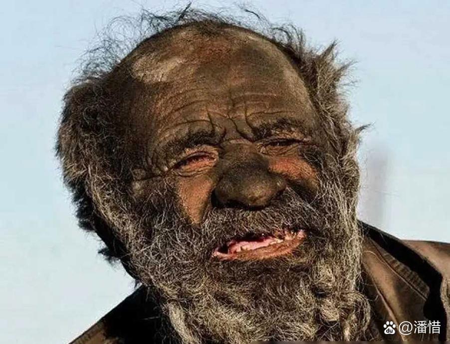 世界上最丑的人图片，世界上最丑的人的图片必须给我看  第2张
