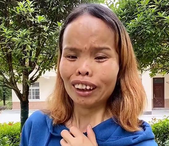 世界上最丑的人图片，世界上最丑的人的图片必须给我看  第5张