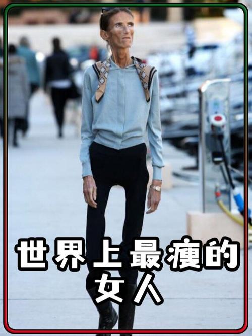 世界最瘦的人，世界最瘦的人是多少斤  第1张
