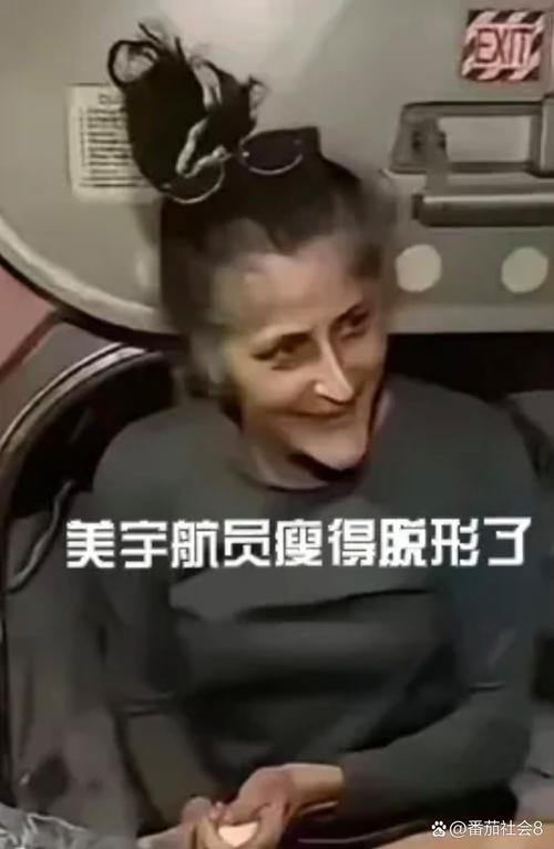 世界最瘦的人，世界最瘦的人是多少斤  第3张