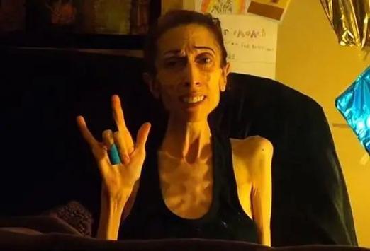 世界最瘦的人，世界最瘦的人是多少斤  第5张
