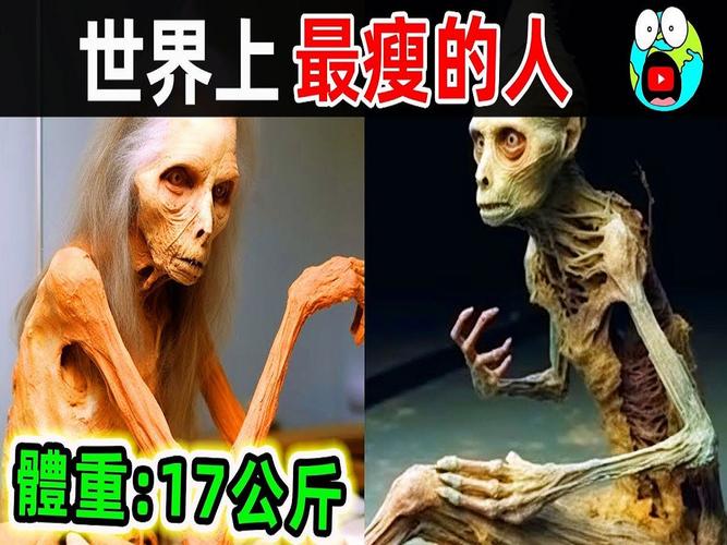 世界最瘦的人，世界最瘦的人是多少斤  第6张