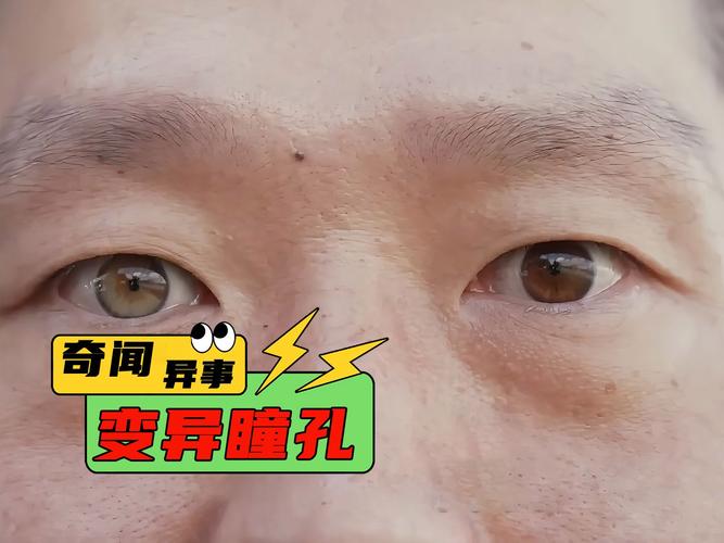 世上阴阳眼是真的吗？世界上有阴阳眼人吗？  第1张