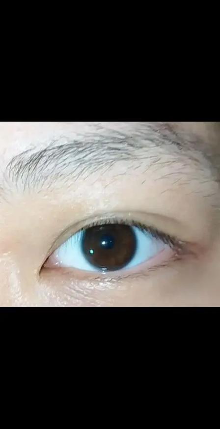 所谓的阴阳眼是真的吗？阴阳眼的真实性？  第6张