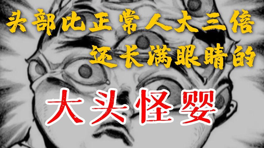 香港大头怪婴最后去哪了？香港大头怪婴最后去哪了儿子医院在医院香港医院？  第1张