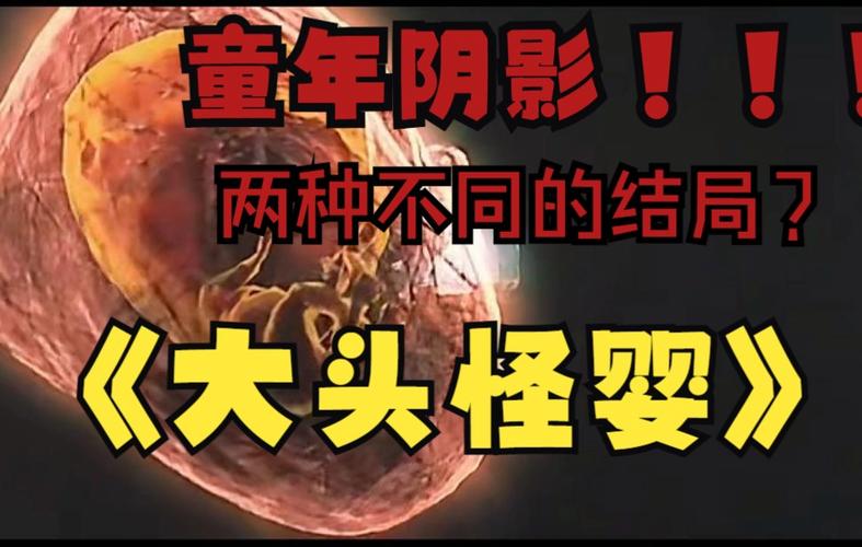 香港大头怪婴最后去哪了？香港大头怪婴最后去哪了儿子医院在医院香港医院？  第3张