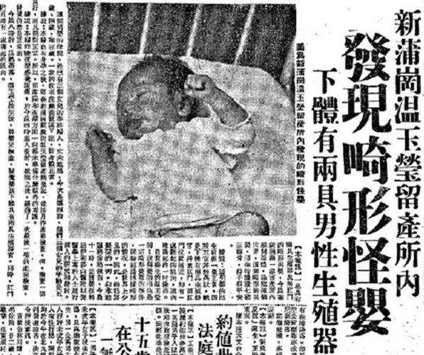 香港大头怪婴最后去哪了？香港大头怪婴最后去哪了儿子医院在医院香港医院？  第4张
