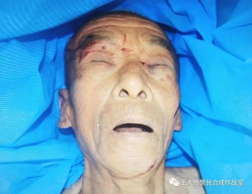 巨人观图片死尸，巨人观图片原图恐怖  第3张