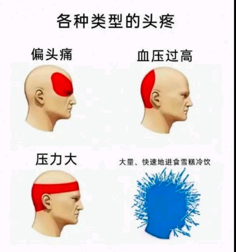 怎么区分偏头痛和神经性头痛，三叉神经疼的6个症状  第2张