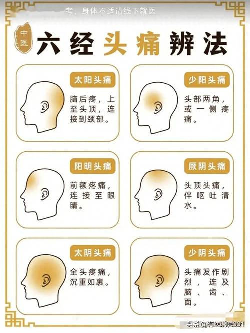 怎么区分偏头痛和神经性头痛，三叉神经疼的6个症状  第3张