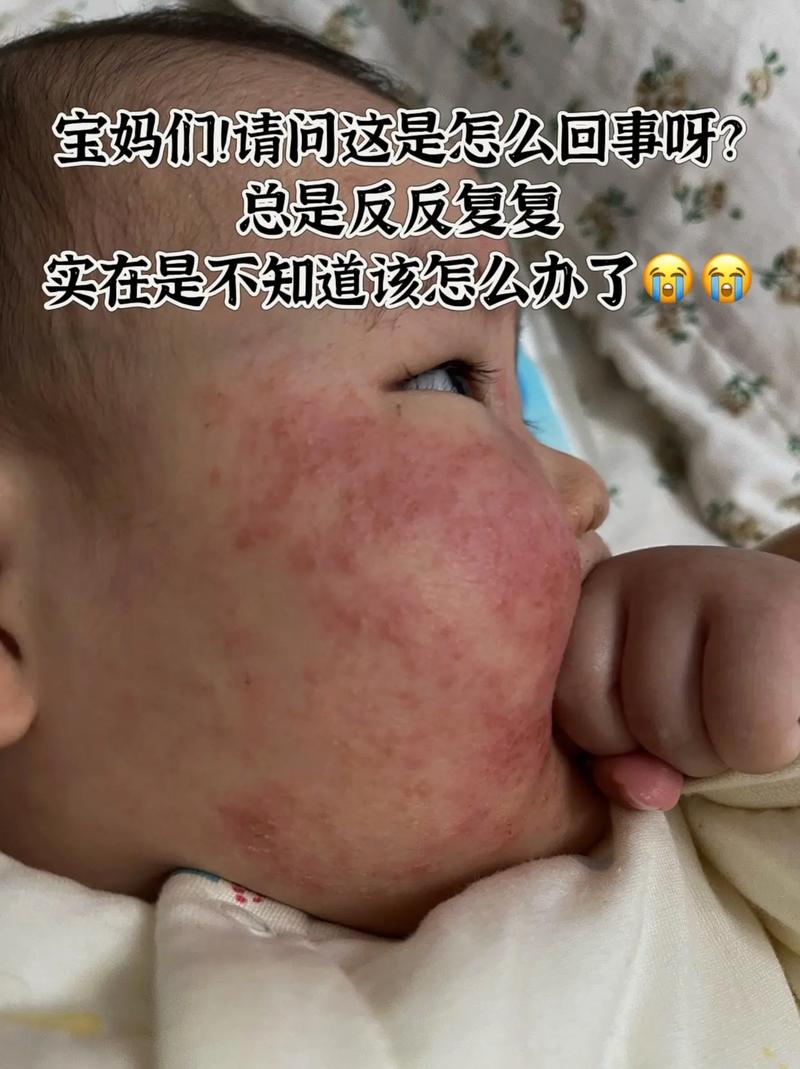 芝麻毛孔图？芝麻毛孔图片男孩？  第1张