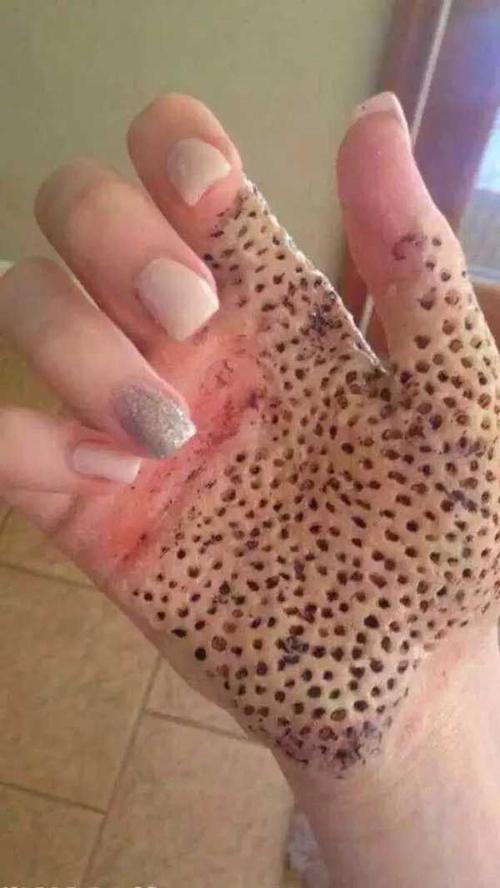 芝麻毛孔图？芝麻毛孔图片男孩？  第6张
