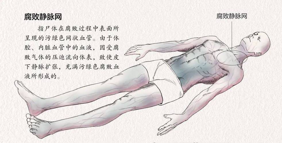 巨人观阴囊，巨人观是啥玩意  第5张