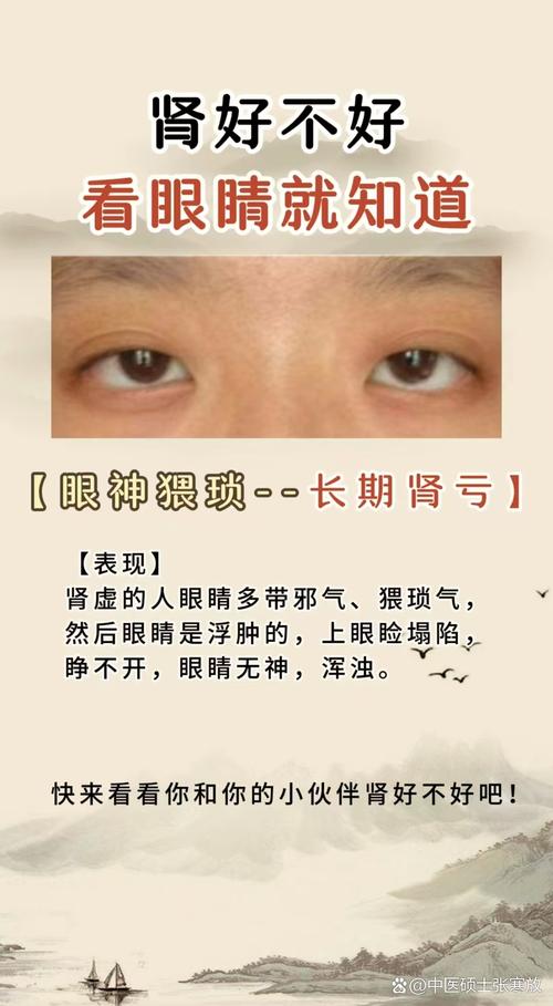 阴阳眼的人有什么特征？阴阳眼的人有什么特征图片女生可爱？  第1张