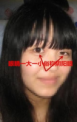 阴阳眼的人有什么特征？阴阳眼的人有什么特征图片女生可爱？  第4张