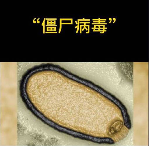 世界前十恐怖病毒？世界前十恐怖病毒视频？  第2张