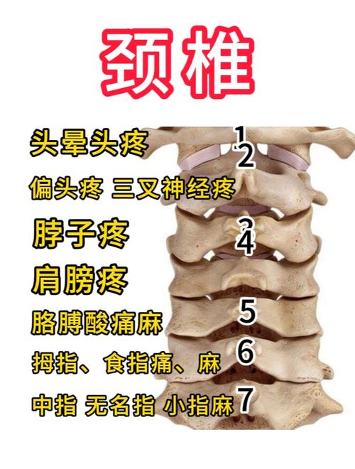 怎样判断自己的头痛类型，怎样判断自己的头痛类型和症状？  第2张