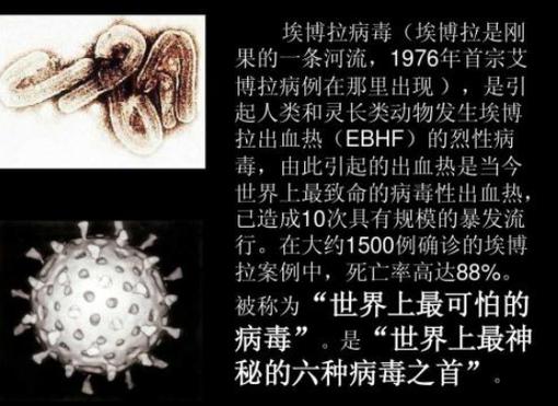 丧尸病毒美国已经有了，美国丧尸病毒爆发是真的吗  第4张