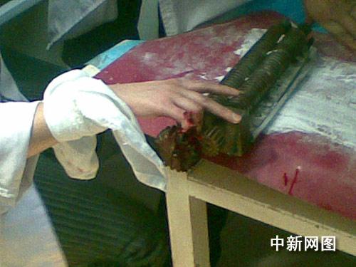 芝麻女孩皮肤恶心图片？芝麻女孩的照片清晰？  第3张