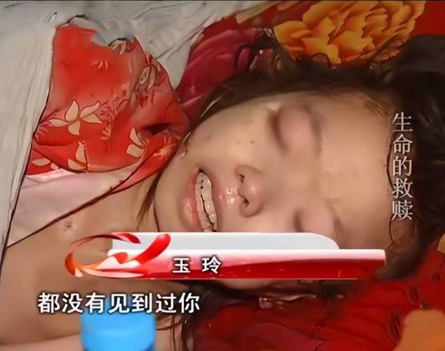 巨人观现象，巨人观现象恐怖图片？  第5张