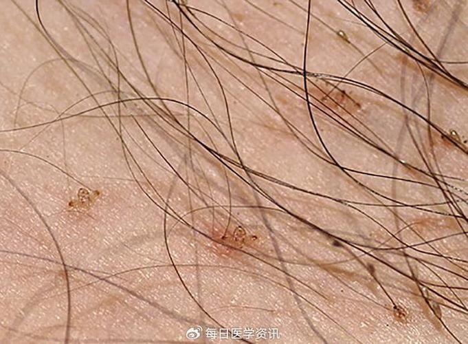 芝麻女孩图片吓人原图虫子版？芝麻女孩的照片儿？  第4张