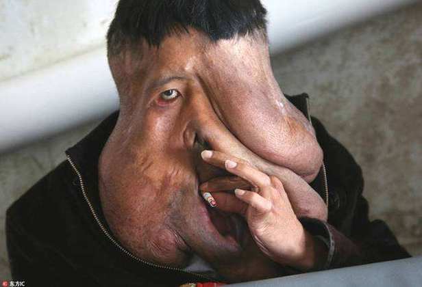 世界上最丑的人长什么样图片，世界上最丑的人是谁的图片  第1张