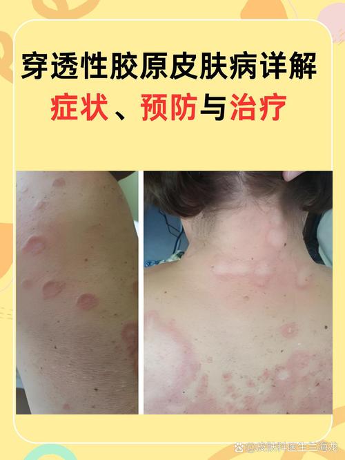 幻觉图片5秒笑死，幻觉图片 恐怖？  第2张
