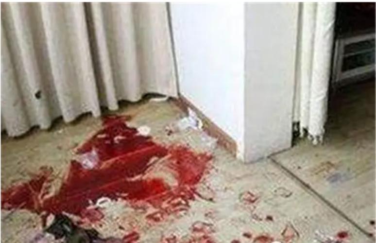 白银案最漂亮死者照片？白银案的案情分析？  第1张