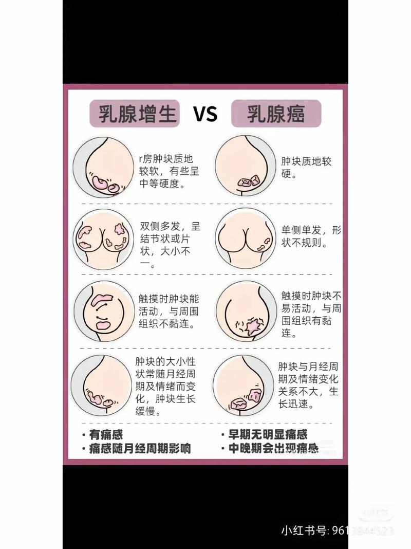 女性乳房挤出透明液体是什么问题，乳房挤出来透明水是什么原因？  第3张
