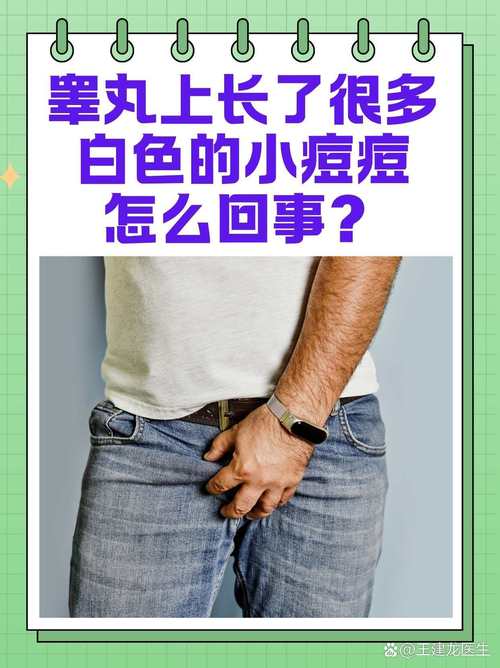 蛋皮长了个小疙瘩图片，睾丸长了像痘痘图片  第4张