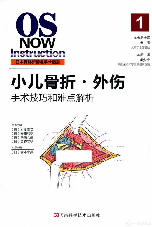 德国骨科很好是什么意思，德国骨科好不好？  第2张