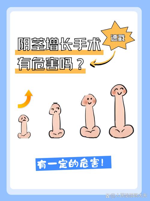 象人族为什么那么长?，象人族是怎么生活的？  第1张