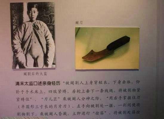 太监是割哪里图解，请问太监是割哪里呢  第1张