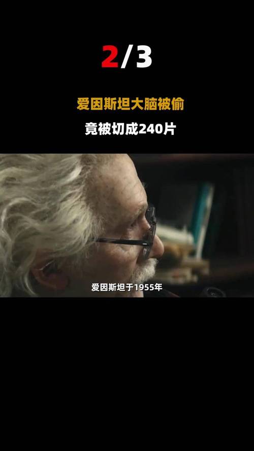 爱因斯坦的大脑被切成240块？爱因斯坦的大脑被切成240块了？  第3张