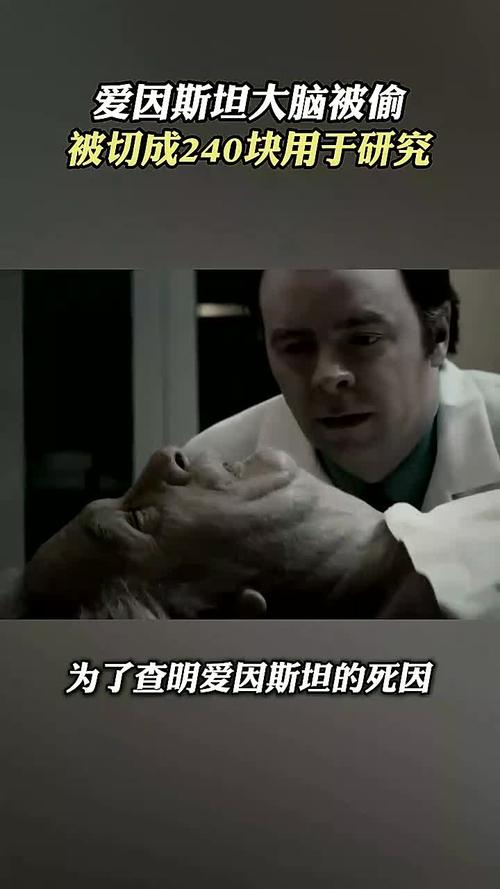 爱因斯坦的大脑被切成240块？爱因斯坦的大脑被切成240块了？  第2张