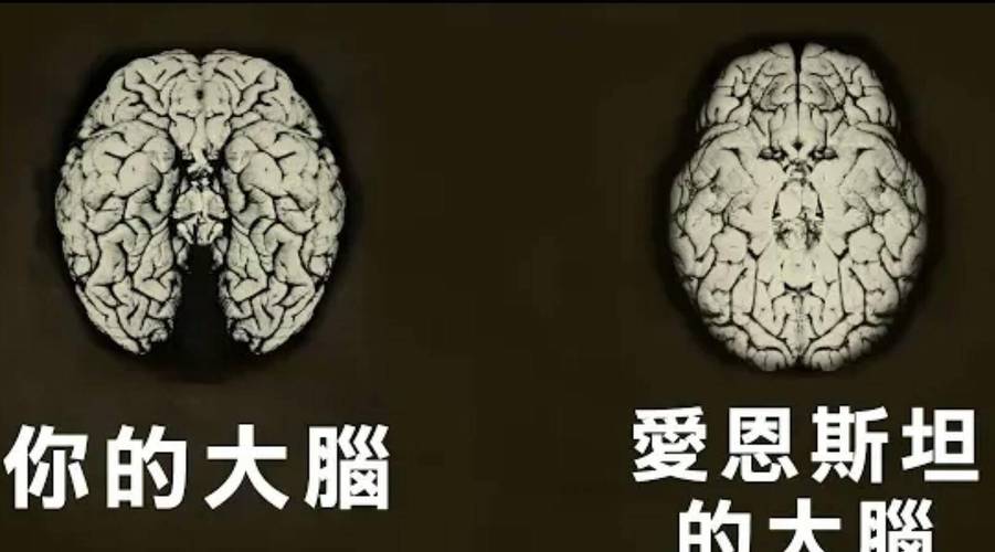 爱因斯坦的大脑被切成240块？爱因斯坦的大脑被切成240块了？  第5张