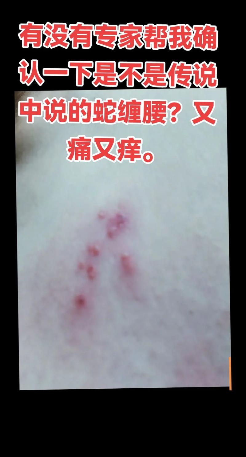 蟒蛇为什么喜欢缠女人？蟒蛇为什么会咬人？  第1张