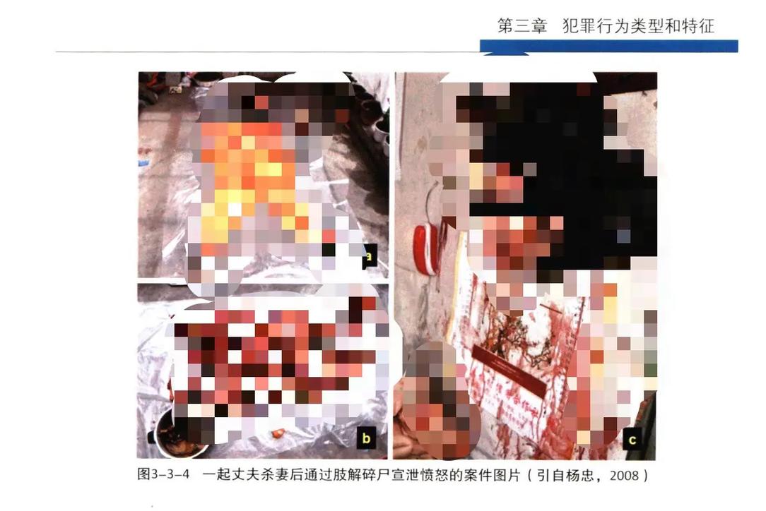 人被剥了皮恐怖图片，人被剥皮能活几个小时  第5张